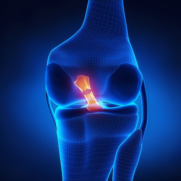 Ligament Injury